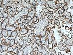 ADAM12 Antibody in Immunohistochemistry (Paraffin) (IHC (P))