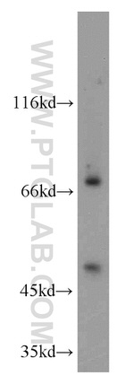 ADAM12 Antibody in Western Blot (WB)