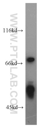 FKBP5 Antibody in Western Blot (WB)