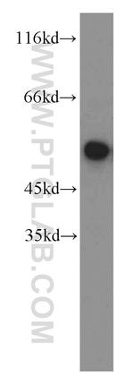 FKBP5 Antibody in Western Blot (WB)