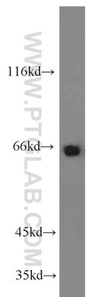 PTH2R Antibody in Western Blot (WB)