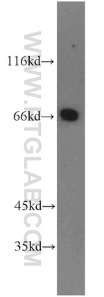 PTH2R Antibody in Western Blot (WB)