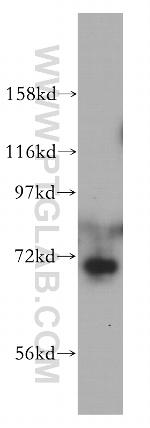 CSTF2T Antibody in Western Blot (WB)