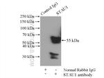STAU1 Antibody in Immunoprecipitation (IP)