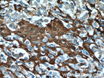 S100A9 Antibody in Immunohistochemistry (Paraffin) (IHC (P))