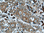 FAM3C Antibody in Immunohistochemistry (Paraffin) (IHC (P))