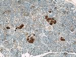 FAM3C Antibody in Immunohistochemistry (Paraffin) (IHC (P))