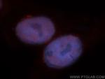 MBD3 Antibody in Immunocytochemistry (ICC/IF)