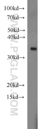 MBD3 Antibody in Western Blot (WB)