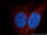 ITPKA Antibody in Immunocytochemistry (ICC/IF)