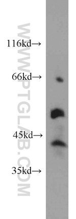 ITPKA Antibody in Western Blot (WB)