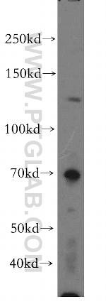 FBXO18 Antibody in Western Blot (WB)