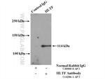 HLTF Antibody in Immunoprecipitation (IP)