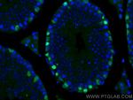 DMRT1 Antibody in Immunohistochemistry (Paraffin) (IHC (P))