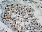 DMRT1 Antibody in Immunohistochemistry (Paraffin) (IHC (P))