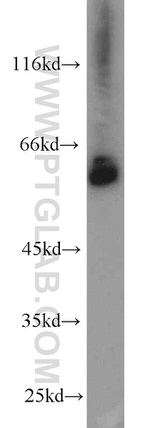 NOX4 Antibody in Western Blot (WB)