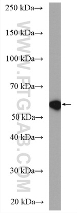 NOX4 Antibody in Western Blot (WB)