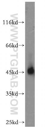 NR1H3 Antibody in Western Blot (WB)