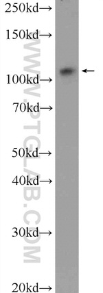 USP15 Antibody in Western Blot (WB)