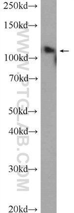 USP15 Antibody in Western Blot (WB)