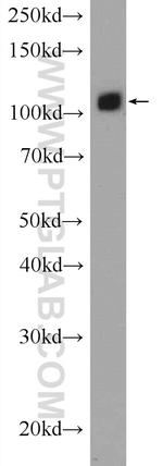 USP15 Antibody in Western Blot (WB)