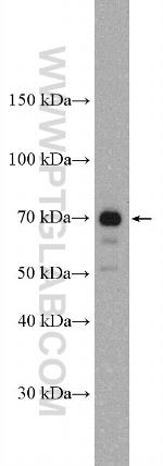 GAA Antibody in Western Blot (WB)