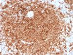 GM-CSF (Granulocyte/Macrophage - Colony Stimulating Factor) Antibody in Immunohistochemistry (Paraffin) (IHC (P))