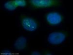 PSMA2 Antibody in Immunocytochemistry (ICC/IF)