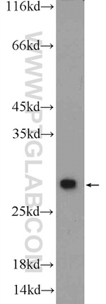 PSMA2 Antibody in Western Blot (WB)