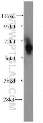 CDT1 Antibody in Western Blot (WB)