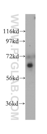 CDT1 Antibody in Western Blot (WB)