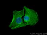 ACTA2/smooth muscle actin Antibody in Immunocytochemistry (ICC/IF)