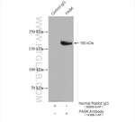 PASK Antibody in Immunoprecipitation (IP)