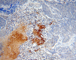 IPO11 Antibody in Immunohistochemistry (Paraffin) (IHC (P))