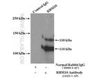 RBM10 Antibody in Immunoprecipitation (IP)