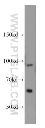 TFIP11 Antibody in Western Blot (WB)