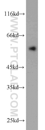 V5-tag Antibody in Western Blot (WB)