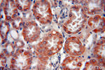 SREBF2 Antibody in Immunohistochemistry (Paraffin) (IHC (P))