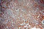 SREBF2 Antibody in Immunohistochemistry (Paraffin) (IHC (P))