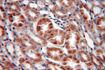 SREBF2 Antibody in Immunohistochemistry (Paraffin) (IHC (P))