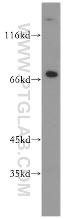 SREBF2 Antibody in Western Blot (WB)