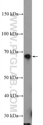 SREBF2 Antibody in Western Blot (WB)