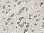 SREBF2 Antibody in Immunohistochemistry (Paraffin) (IHC (P))