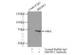 SREBF2 Antibody in Immunoprecipitation (IP)