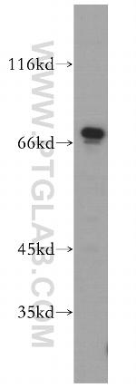 SREBF2 Antibody in Western Blot (WB)