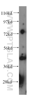 PTPN5 Antibody in Western Blot (WB)