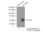 ACADVL Antibody in Immunoprecipitation (IP)