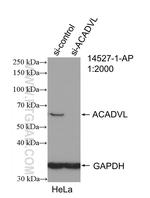 ACADVL Antibody in Western Blot (WB)