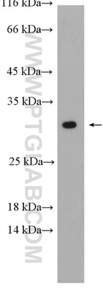 RGS4 Antibody in Western Blot (WB)