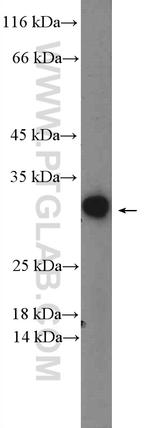 RGS4 Antibody in Western Blot (WB)